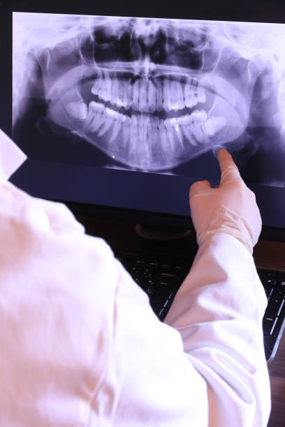 Best Knocked-Out Tooth (Avulsed Tooth) Treatment in Placerville, CA