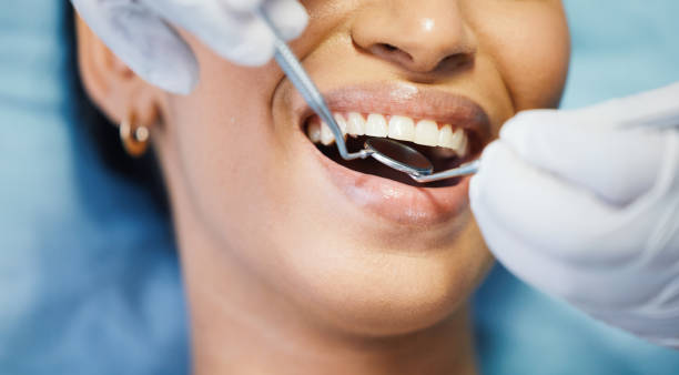 Best Weekend Emergency Dental Services in Placerville, CA